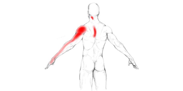 Illustration courtesy of Painotopia.com at http://www.painotopia.com/infraspinatus-muscle.html#pain-zone