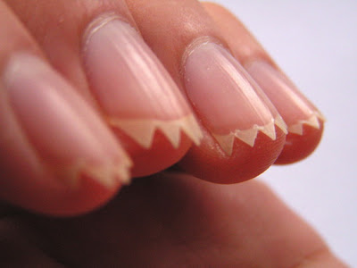 Irritations Jagged Nails
